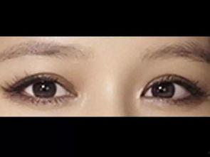 正常人眼睛图片,高清图片带你领略视觉世界的奇迹
