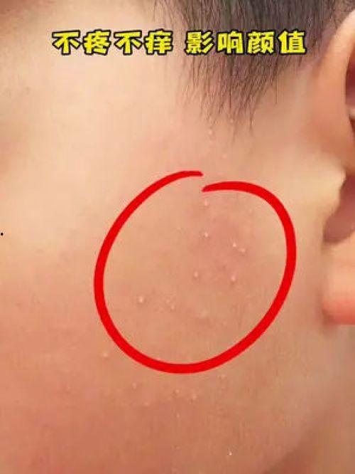 身上有小白点图片,探寻健康与美丽之道