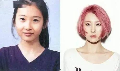 韩国娜娜整容前后,蜕变之路，从韩国网红到明星的美丽逆袭