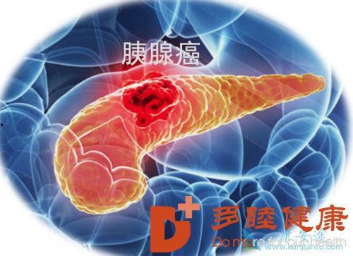 日本胰腺癌,日本研究揭示的发病机制与防治策略