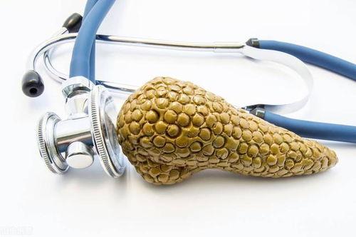 日本胰腺癌,日本研究揭示的发病机制与防治策略