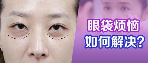 去除眼袋手术视频,专业视频带你直观了解